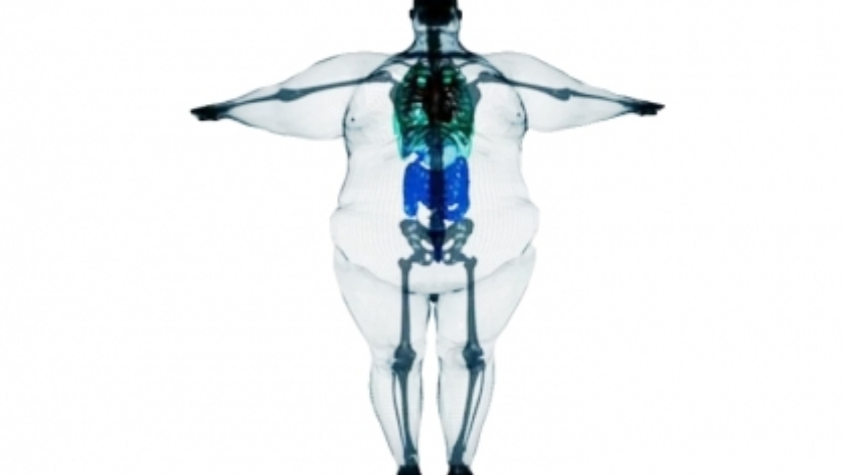 obezitenin-neden-oldugu-saglik-sorunlari